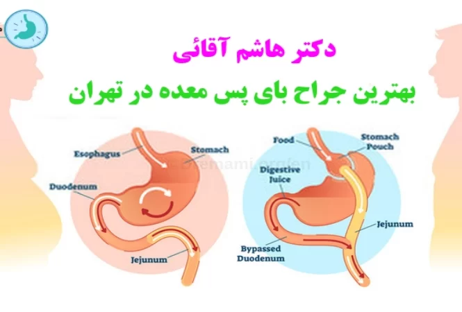 بهترین جراح بای پس